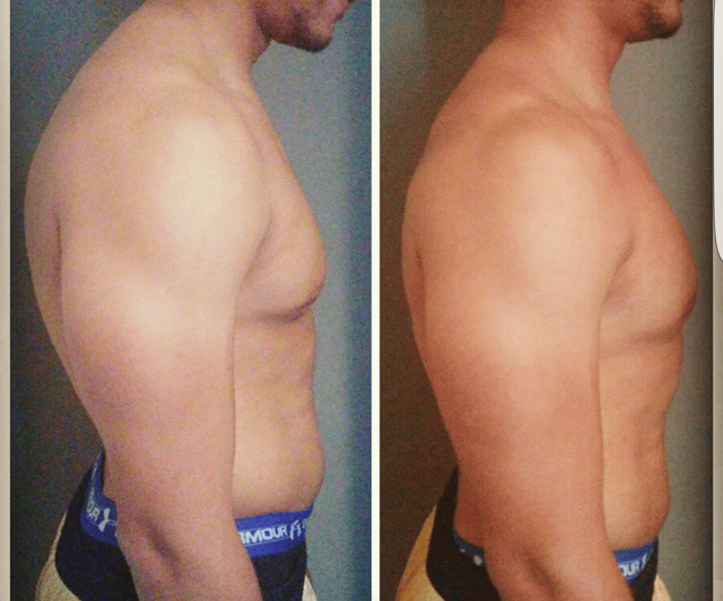Postural Correction — Side Profile